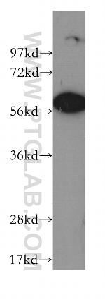 CD69 Antibody in Western Blot (WB)