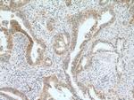 IFNGR1 Antibody in Immunohistochemistry (Paraffin) (IHC (P))