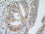 IFNGR1 Antibody in Immunohistochemistry (Paraffin) (IHC (P))