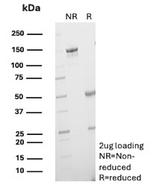 Heat Shock Protein 105 kDa/HSP105 (Basaloid Skin Tumor Marker) Antibody in SDS-PAGE (SDS-PAGE)