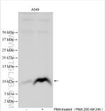 CXCL5 Antibody in Western Blot (WB)