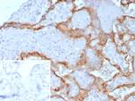 HCG-beta (Pregnancy and Choriocarcinoma Marker) Antibody in Immunohistochemistry (Paraffin) (IHC (P))