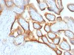 HCG-alpha Monoclonal Antibody (SPM552)