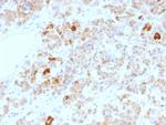 LH, alpha (Luteinizing Hormone, alpha) Monoclonal Antibody (LHa, 756)