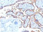 HCG-beta (Pregnancy and Choriocarcinoma Marker) Monoclonal Antibody (rHCGa/6975)