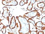 HCG-beta (Pregnancy and Choriocarcinoma Marker) Antibody in Immunohistochemistry (Paraffin) (IHC (P))