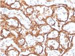 HCG-beta Recombinant Rabbit Monoclonal Antibody (HCGa, 2728R)
