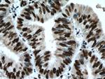 PUF60 Antibody in Immunohistochemistry (Paraffin) (IHC (P))