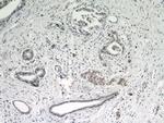 ARHI Antibody in Immunohistochemistry (Paraffin) (IHC (P))