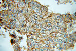 Kallikrein 2 Antibody in Immunohistochemistry (Paraffin) (IHC (P))