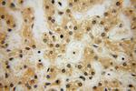 HERP Antibody in Immunohistochemistry (Paraffin) (IHC (P))