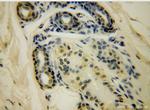 HERP Antibody in Immunohistochemistry (Paraffin) (IHC (P))
