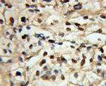 SMARCE1 Antibody in Immunohistochemistry (Paraffin) (IHC (P))