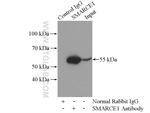 SMARCE1 Antibody in Immunoprecipitation (IP)