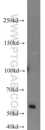SMARCE1 Antibody in Western Blot (WB)