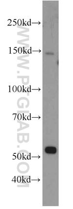 SMARCE1 Antibody in Western Blot (WB)