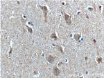 PTHLH Antibody in Immunohistochemistry (Paraffin) (IHC (P))