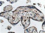 PTHLH Antibody in Immunohistochemistry (Paraffin) (IHC (P))