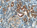 PTHLH Antibody in Immunohistochemistry (Paraffin) (IHC (P))