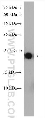 PTHLH Antibody in Western Blot (WB)