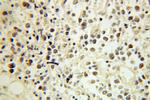 ERCC2 Antibody in Immunohistochemistry (Paraffin) (IHC (P))