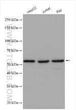KPNA2 Antibody in Western Blot (WB)