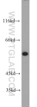 KPNA2 Antibody in Western Blot (WB)