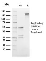 HCG-beta (Pregnancy and Choriocarcinoma Marker) Antibody in SDS-PAGE (SDS-PAGE)