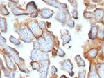 HCG-beta (Pregnancy and Choriocarcinoma Marker) Antibody in Immunohistochemistry (Paraffin) (IHC (P))