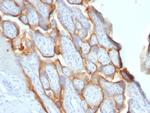 HCG-beta Monoclonal Antibody (SPM529)