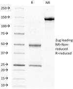 HCG-beta (Pregnancy and Choriocarcinoma Marker) Antibody in SDS-PAGE (SDS-PAGE)