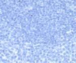 HCG-beta (Pregnancy and Choriocarcinoma Marker) Antibody in Immunohistochemistry (Paraffin) (IHC (P))