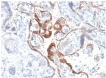 HCG-beta Recombinant Rabbit Monoclonal Antibody (HCGb, 1985R)