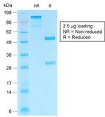 HCG-beta Antibody in SDS-PAGE (SDS-PAGE)