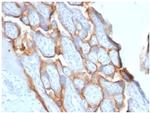 HCG-beta Recombinant Rabbit Monoclonal Antibody (HCGb, 1996R)