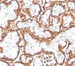 HCG-beta (Pregnancy and Choriocarcinoma Marker) Recombinant Rabbit Monoclonal Antibody (HCGb/4709R)