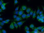 IVD Antibody in Immunocytochemistry (ICC/IF)