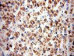 IVD Antibody in Immunohistochemistry (Paraffin) (IHC (P))