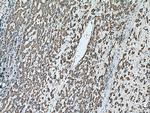 IVD Antibody in Immunohistochemistry (Paraffin) (IHC (P))