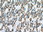 IVD Antibody in Immunohistochemistry (Paraffin) (IHC (P))
