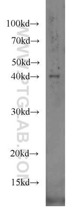 IVD Antibody in Western Blot (WB)