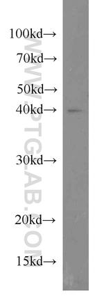 IVD Antibody in Western Blot (WB)