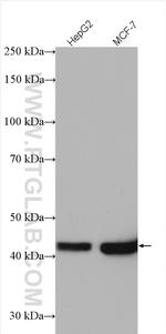 IVD Antibody in Western Blot (WB)