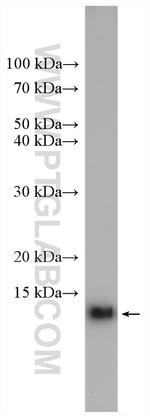 Cystatin B Antibody in Western Blot (WB)