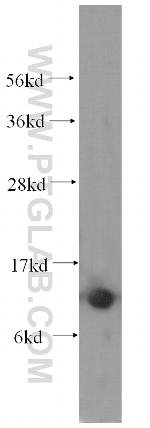 Cystatin B Antibody in Western Blot (WB)
