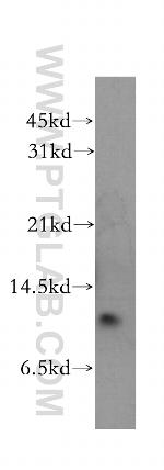 Cystatin B Antibody in Western Blot (WB)