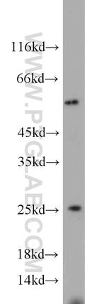 TPT1 Antibody in Western Blot (WB)