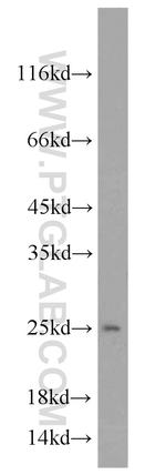 TPT1 Antibody in Western Blot (WB)