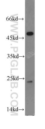 TPT1 Antibody in Western Blot (WB)