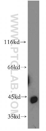 DUSP9 Antibody in Western Blot (WB)